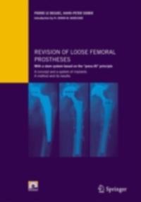 Revision of loose femoral prostheses with a stem system based on the &quote;press-fit&quote; principle