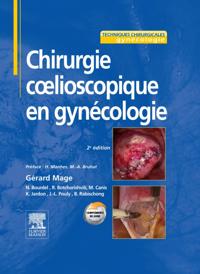 Chirurgie c lioscopique en gynecologie