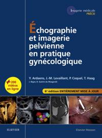Echographie et imagerie pelvienne en pratique gynecologique