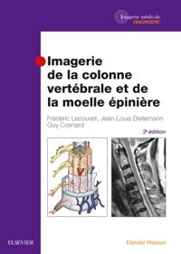 Imagerie de la colonne vertebrale et de la moelle epiniere