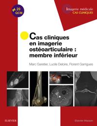 Cas cliniques en imagerie osteoarticulaire : membre inferieur