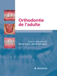 Orthodontie de l'adulte