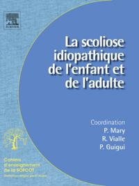 La scoliose idiopathique de l'enfant et de l'adulte