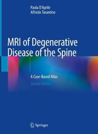 Bokomslag för "MRI of Degenerative Disease of the Spine"