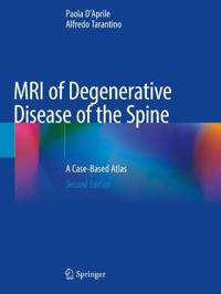 MRI of Degenerative Disease of the Spine