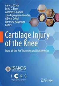 Kirjan kansi "Cartilage Injury of the Knee"