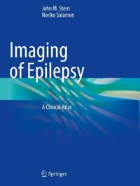 Bokomslag for "Imaging of Epilepsy"