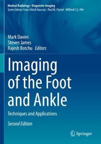 Imaging of the Foot and Ankle