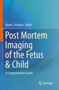 Post Mortem Imaging of the Fetus & Child