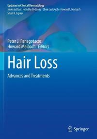 Hair Loss