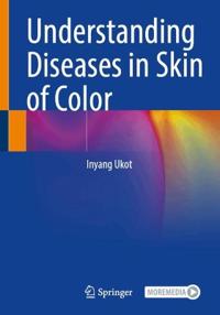 Understanding Diseases in Skin of Color