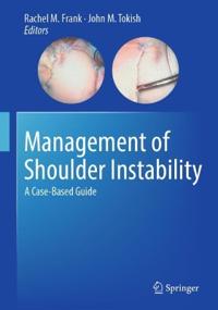 Management of Shoulder Instability