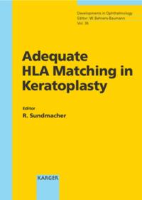 Adequate HLA Matching in Keratoplasty