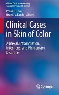 Clinical Cases in Skin of Color