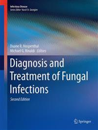Diagnosis and Treatment of Fungal Infections