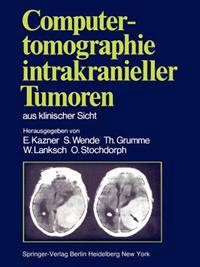 Computertomographie intrakranieller Tumoren aus klinischer Sicht