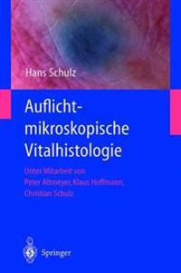 Auflichtmikroskopische Vitalhistologie