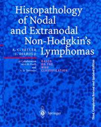 Histopathology of Nodal and Extranodal Non-Hodgkin’s Lymphomas