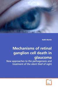 Mechanisms of retinal ganglion cell death in glaucoma