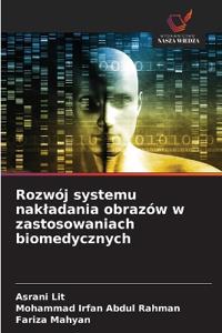 Rozwój systemu nakladania obrazów w zastosowaniach biomedycznych