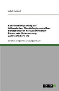 Konstruktionsplanung Auf Teilbezahntem Oberkiefergipsmodell Zur Herstellung Von Herausnehmbarem Zahnersatz (Unterweisung Zahntechniker / -In)