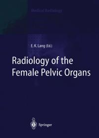 Radiology of the Female Pelvic Organs