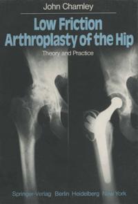 Low Friction Arthroplasty of the Hip