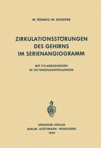 Zirkulationsstörungen des Gehirns im Serienangiogramm