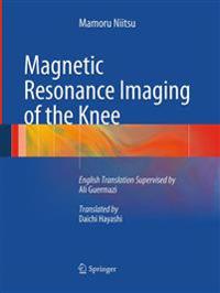 Magnetic Resonance Imaging of the Knee