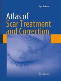 Bokomslag for "Atlas of Scar Treatment and Correction"