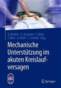 Mechanische Unterstützung im akuten Kreislaufversagen