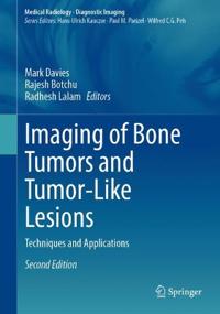 Imaging of Bone Tumors and Tumor-Like Lesions