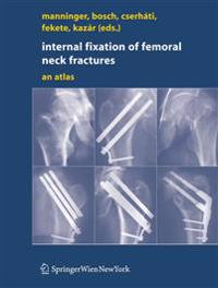 Internal fixation of femoral neck fractures