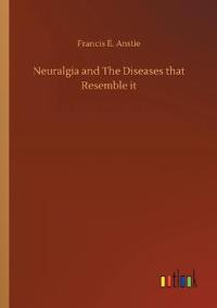 Neuralgia and The Diseases that Resemble it