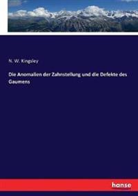 Die Anomalien der Zahnstellung und die Defekte des Gaumens