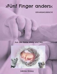 Fünf Finger anders