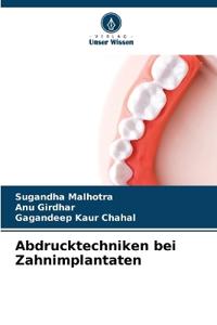 Abdrucktechniken bei Zahnimplantaten