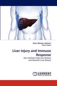 Liver Injury and Immune Response