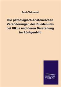 Die Pathologisch-Anatomischen Veranderungen Des Duodenums Bei Ulkus Und Deren Darstellung Im Rontgenbild