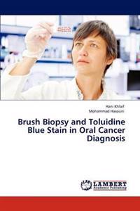 Brush Biopsy and Toluidine Blue Stain in Oral Cancer Diagnosis