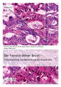 Der Feind in deiner Brust. Früherkennung und Behandlung von Brustkrebs
