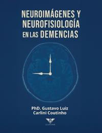 Neuroimágenes y neurofisiología en las demencias