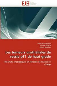 Les tumeurs urothéliales de vessie pt1 de haut grade