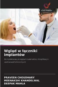 Wgląd w lączniki implantów
