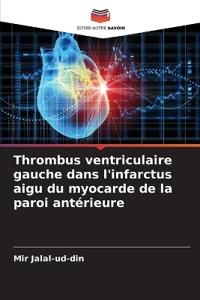 Thrombus ventriculaire gauche dans l'infarctus aigu du myocarde de la paroi antérieure