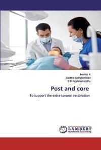 Post and core