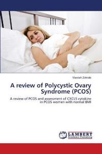 A review of Polycystic Ovary Syndrome (PCOS)