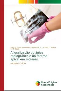 A localização do ápice radiográfico e do forame apical em molares
