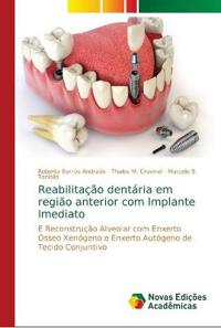 Reabilitação dentária em região anterior com Implante Imediato