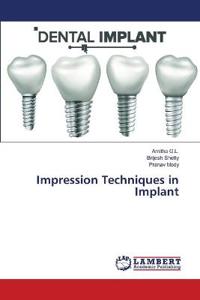Impression Techniques in Implant